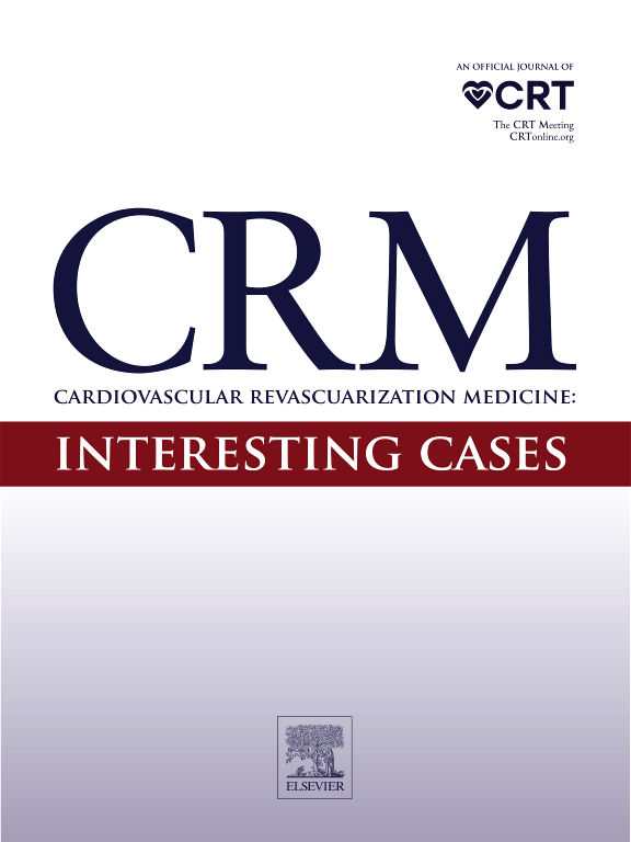 Go to journal home page - Cardiovascular Revascularization Medicine: Interesting Cases